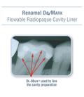 Renamel De-MARK Flowable Radiopaque Cavity Liner
